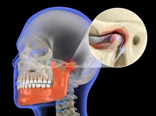 Jaw Locked Shut? What to Do for Trismus (Lockjaw) Emergency