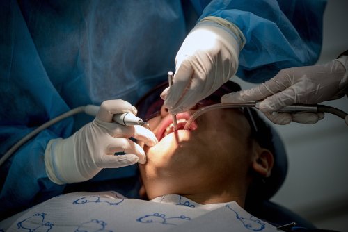 Atypical Odontalgia: Why Your Tooth Hurts After a Root Canal